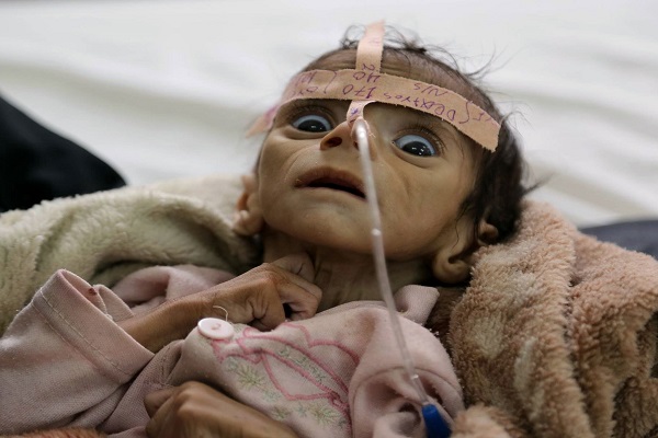 Saudi War on Yemen: Kids Paying Heaviest Price