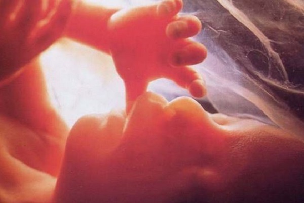 Human embryo