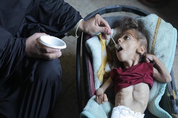 Malnutrition crisis worsening in Gaza as Israel continues blocking aid.