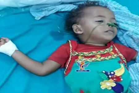 کودکان یمن و کابوسی هزار روزه کودکان یمن و کابوسی هزار روزه