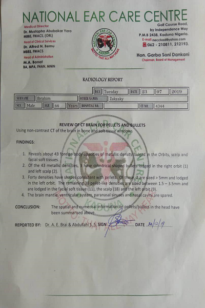 منابع بیمارستانی: ۴۳ ترکش در بدن شیخ زکزاکی وجود دارد منابع بیمارستانی: ۴۳ ترکش در بدن شیخ زکزاکی وجود دارد