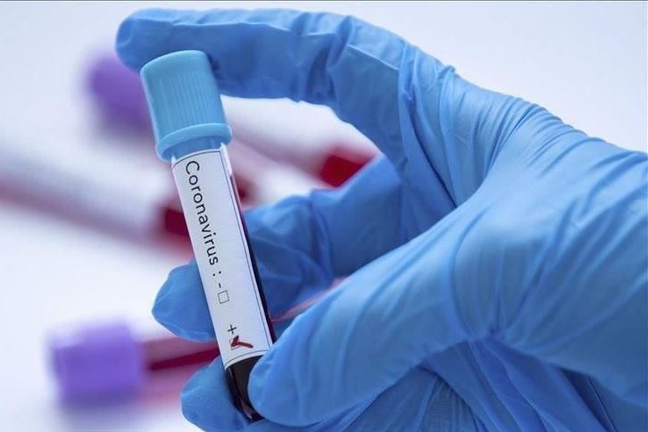 کرونا کرونا