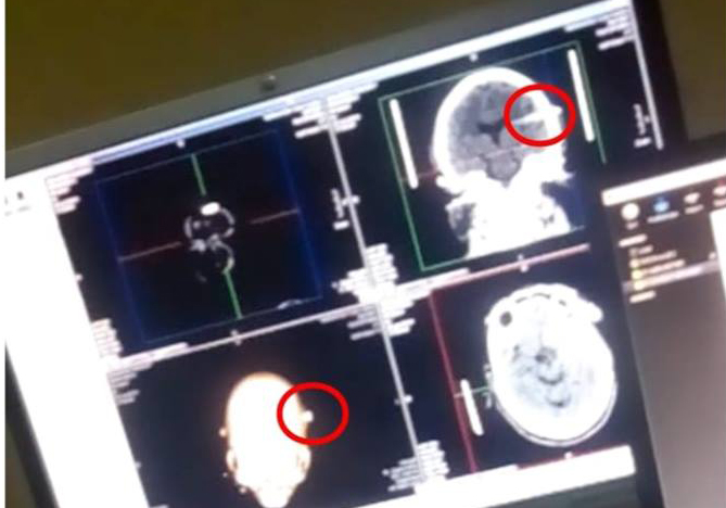 تصاویری از وضعیت وخیم شیخ زکزاکی&nbsp;