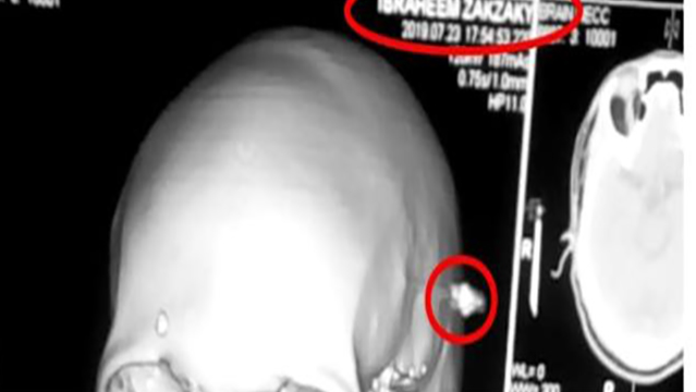 دختر شیخ زکزاکی: پزشکان مجاز به معاینه پدرم نیستند&nbsp;