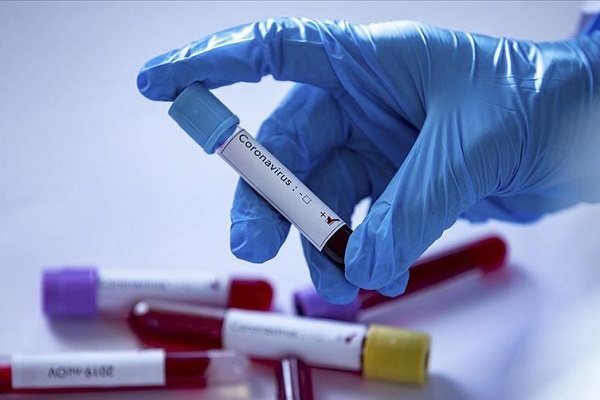 از درخواست بودجه 5 تریلیون دلاری تا هشدار با تابوت در خیابان&zwnj;های فیلیپین