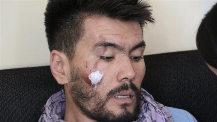 بیانیه طالبان درباره لیست سیاه آمریکا/ گزارش دیده&zwnj;بان حقوق&zwnj;بشر درباره شکنجه روزنامه&zwnj;نگاران افغان