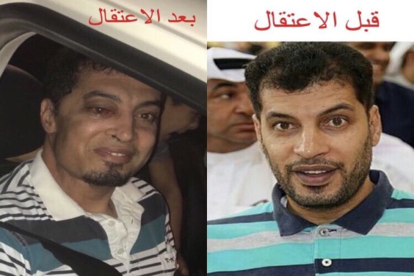 شکنجه و اهمال پزشکی، عامل شهادت یک زندانی دیگر در بحرین + فیلم