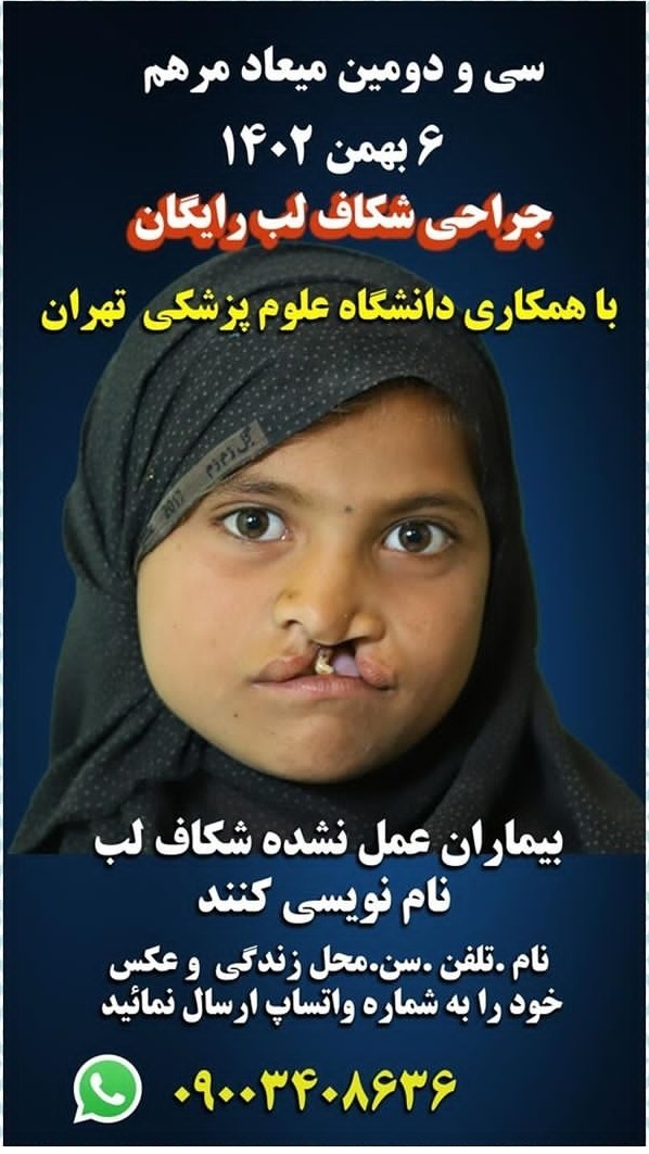 جراحی رایگان شکاف لب این‌بار در دانشگاه علوم پزشکی تهران