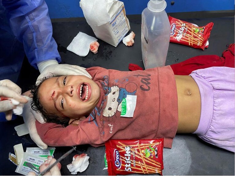 قرآن؛ تسکین آلام مجروحان غزه در عملهای بدون بیهوشی + فیلم قرآن؛ تسکین آلام مجروحان غزه در عملهای بدون بیهوشی + فیلم