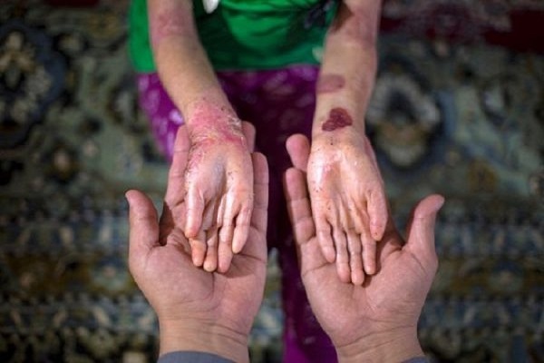 بیماری پوستی