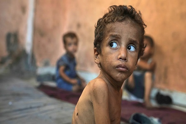 گرسنگی کودکان غزه گرسنگی کودکان غزه